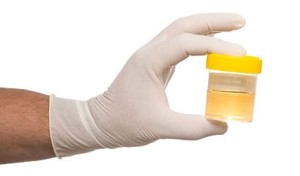exame-de-urina